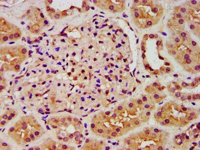 ANK3 Antibody