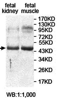 ANKRD40 Rabbit Polyclonal Antibody