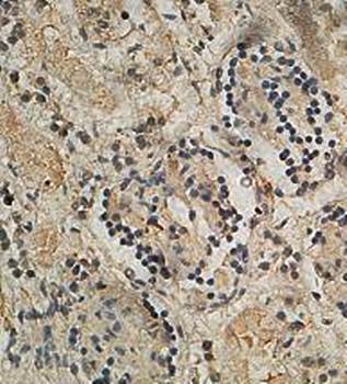 ANKRD40 Rabbit Polyclonal Antibody
