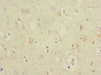 ANKS1B Antibody