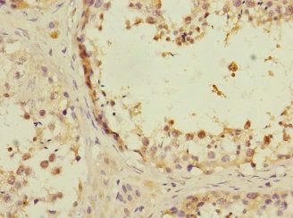 ANKS1B Antibody