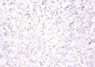ANXA5 Antibody