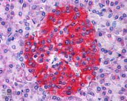 Annexin A10/Annexin 14 Antibody