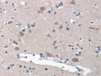 ANP32C Antibody