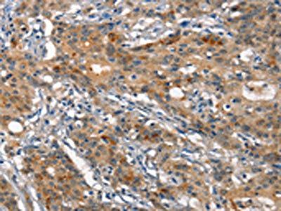 ANP32C Antibody