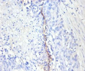 MKI67 Antibody