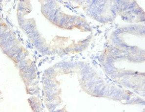 MKI67 Antibody