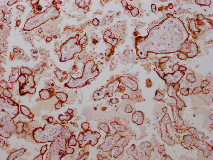 ANXA1 Antibody