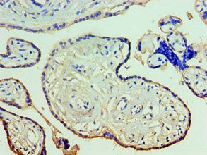 ANXA11 Antibody