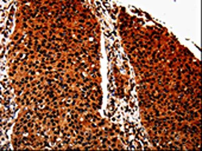 ANXA7 Antibody