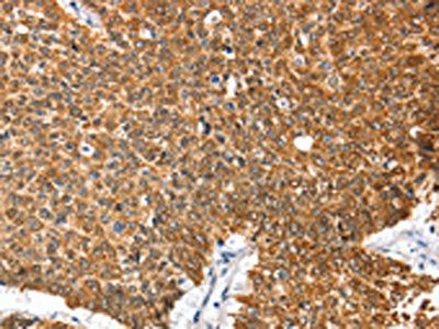 ANXA9 Antibody