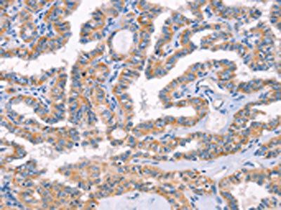 AP1B1 Antibody