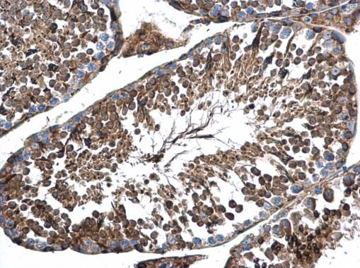 AP4M1 Rabbit Polyclonal Antibody