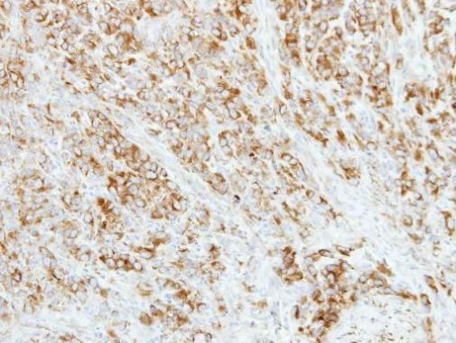 AP4M1 Rabbit Polyclonal Antibody