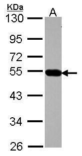 AP4M1 Rabbit Polyclonal Antibody
