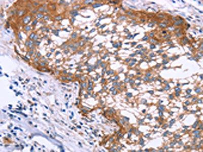 APAF1 Antibody