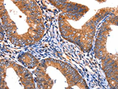 APAF1 Antibody