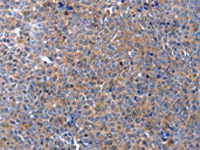 APAF1 Antibody