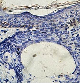 APAF1 Rabbit Polyclonal Antibody