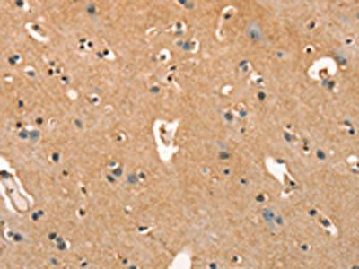 APC Antibody