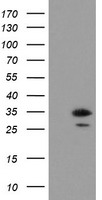Apc11 Antibody