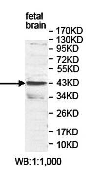 APLNR Rabbit Polyclonal Antibody