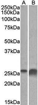 Goat anti-APOD (aa70-80) Antibody