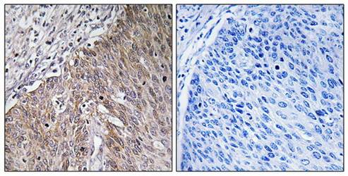 APOL2 Antibody