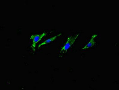 APP Antibody