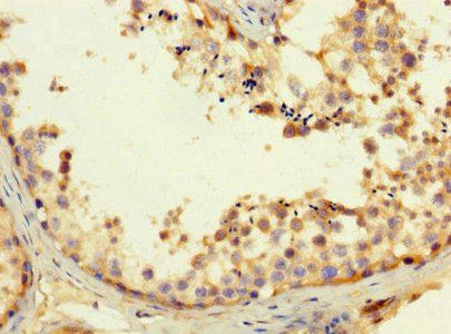 APP Antibody