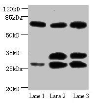 APP Antibody