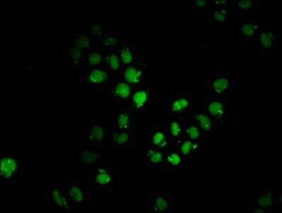 APPL2 Antibody