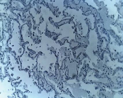 Rabbit anti Human Aprataxin Antibody