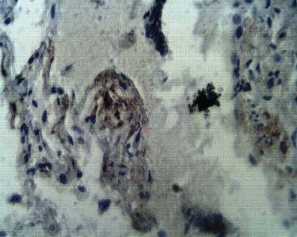 Rabbit anti Human Aprataxin Antibody