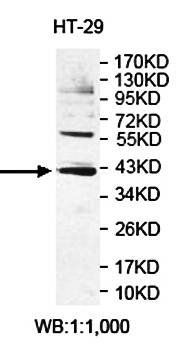APTX Rabbit Polyclonal Antibody