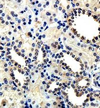 APTX Rabbit Polyclonal Antibody