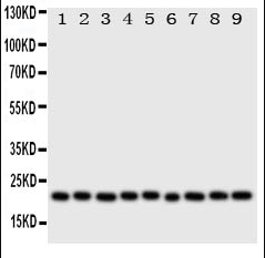 Cytoglobin/CYGB Rabbit Polyclonal Antibody