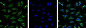 AQP4 Antibody