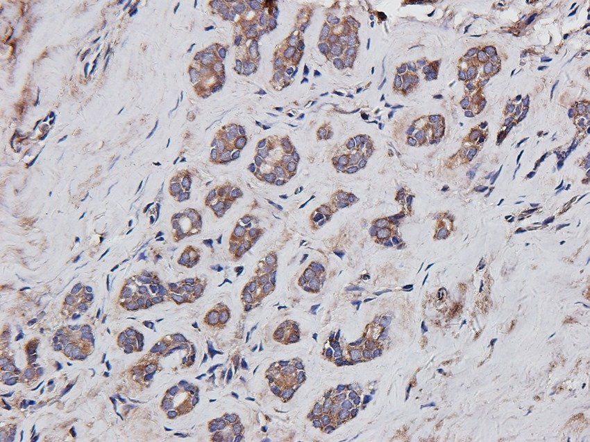 Aquaporin 5 Rabbit Polyclonal Antibody