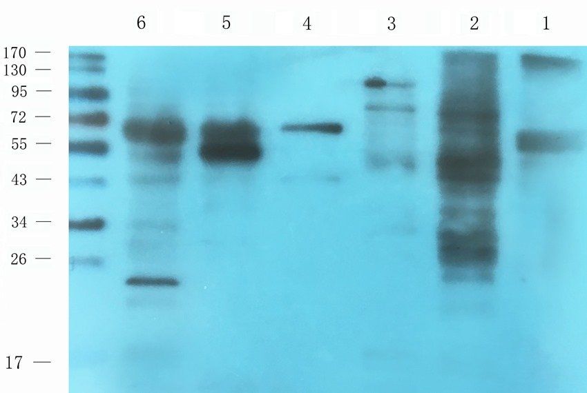 Aquaporin 5 Rabbit Polyclonal Antibody