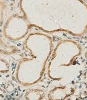 Aquaporin 3 Rabbit Polyclonal Antibody