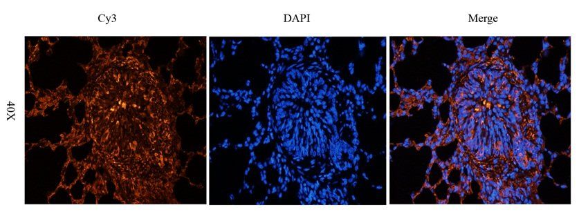 Aquaporin 1 antibody