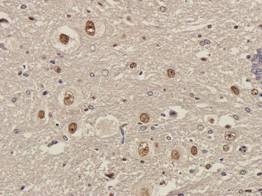 Aquaporin 1 antibody