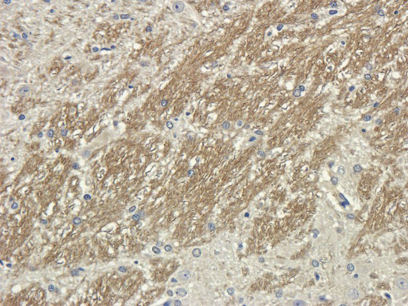 Aquaporin 4 antibody