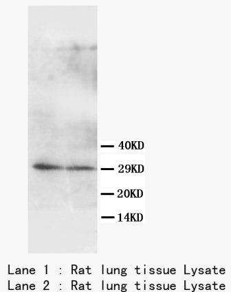 Aquaporin 5/AQP5 Rabbit Polyclonal Antibody
