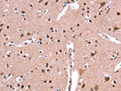 ARC Antibody