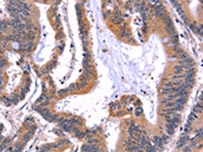 ARC Antibody