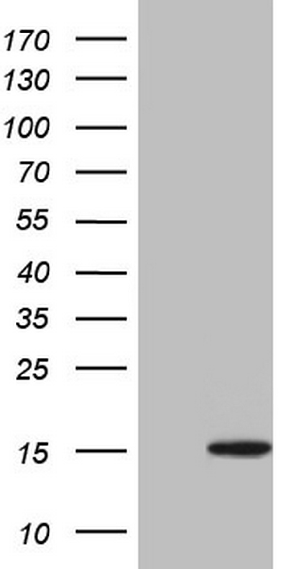 AREB6 Antibody