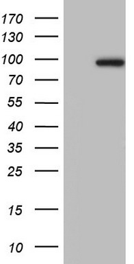 ZEB1 Antibody