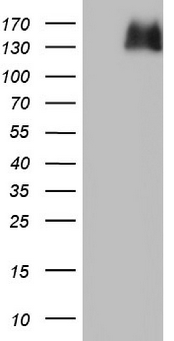 AREB6 Antibody